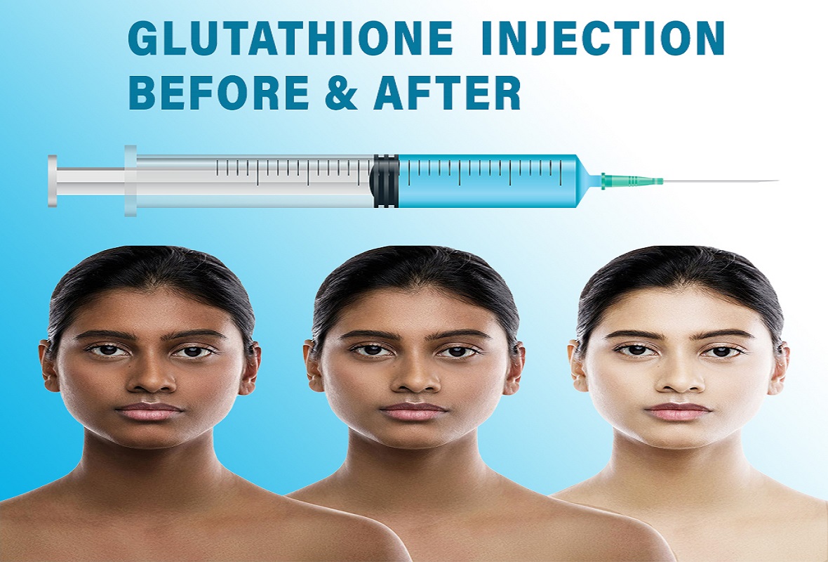 Glutathione Injection Before And After Glutathione Injection Before And After